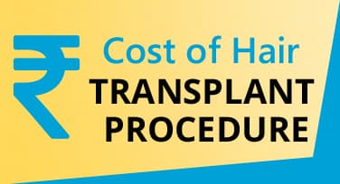 Cost of Hair Transplant in Chandigarh